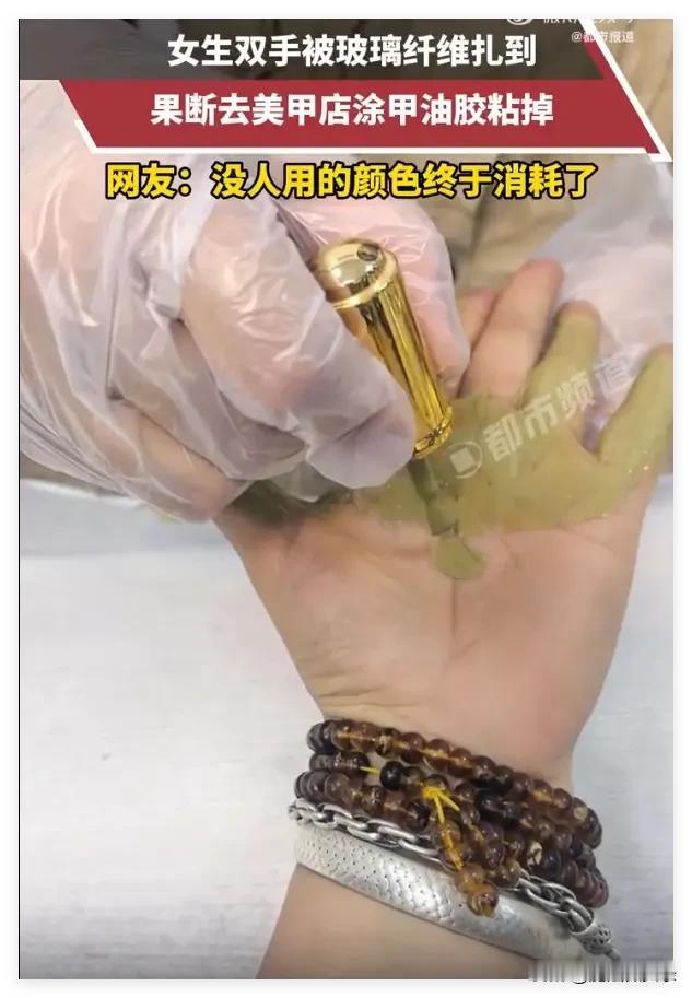 浙江一女生手被玻璃纤维扎到，果断去美甲店涂了一层甲油胶，等胶干透后一撕，纤维全被