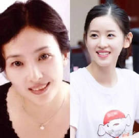 章泽天比刘亦菲还像刘亦菲妈妈在娱乐圈和名媛圈里，明星们的外貌常常是大家津津乐道的