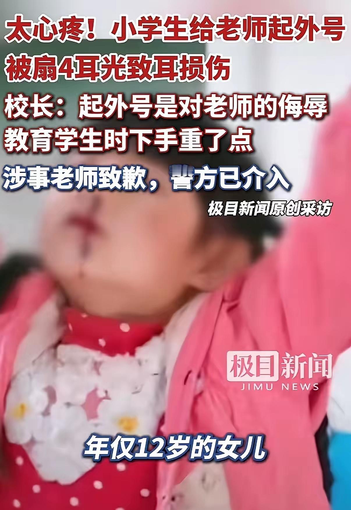 如何看待？小学生给老师起外号，被扇4耳光

据媒体报道，云南昭通一家私立学校6年