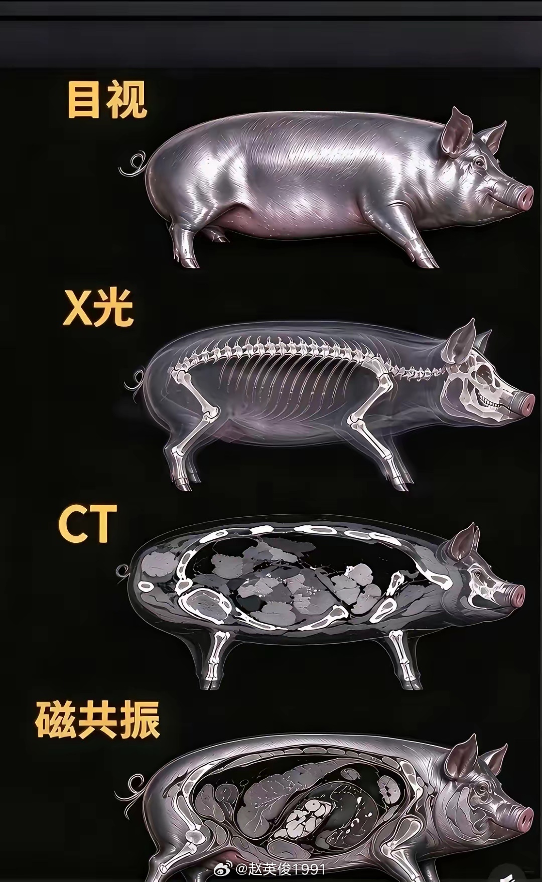 清晰明了，这就是为什么核磁共振这么贵。 ​​​