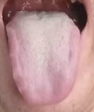 男性功能状态不佳？阳虚夹瘀才是关键，通补同调更稳妥






有不少男同志年纪