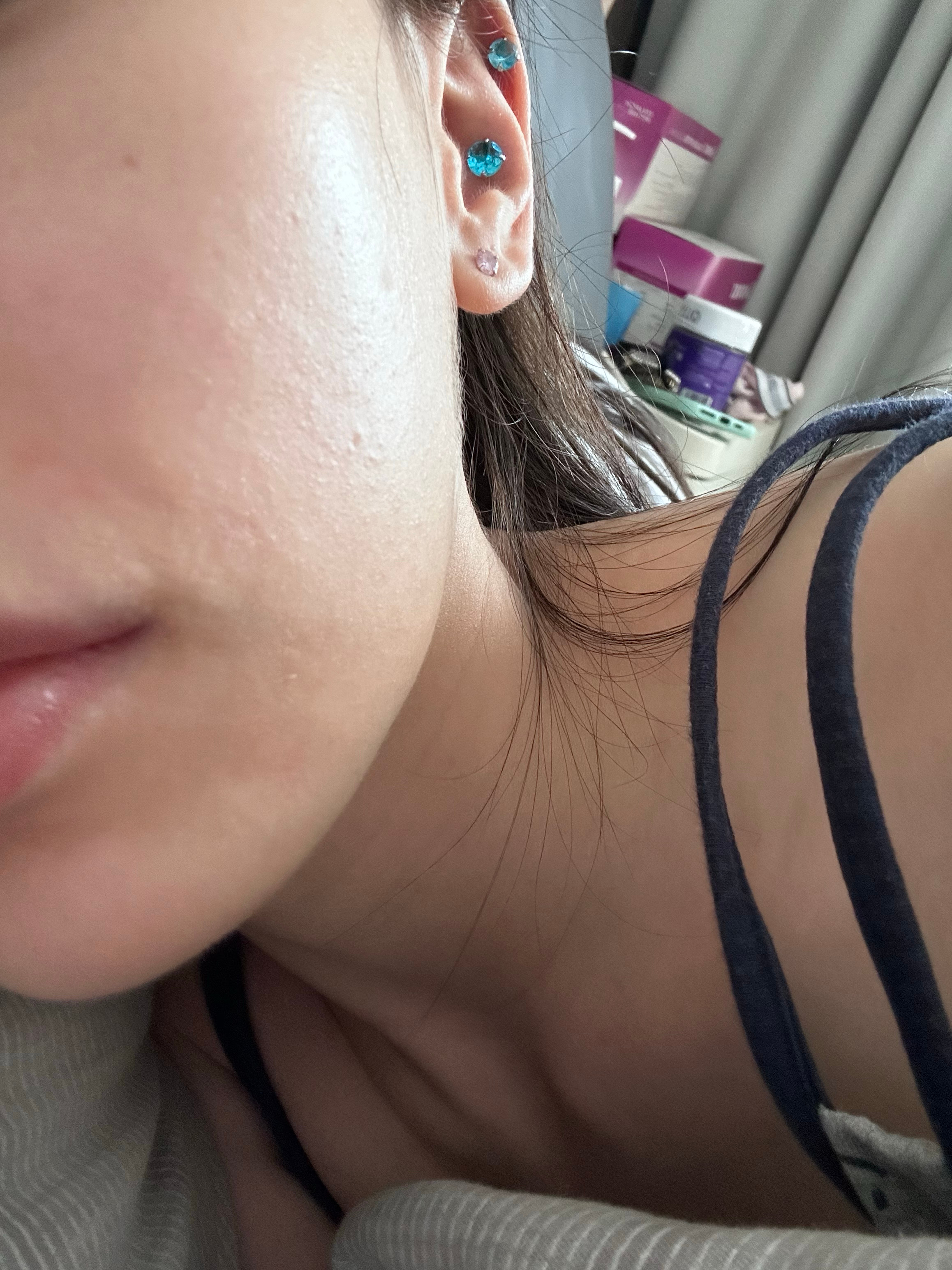 用了一个卸妆巾 然后过敏了[晕] ​​​