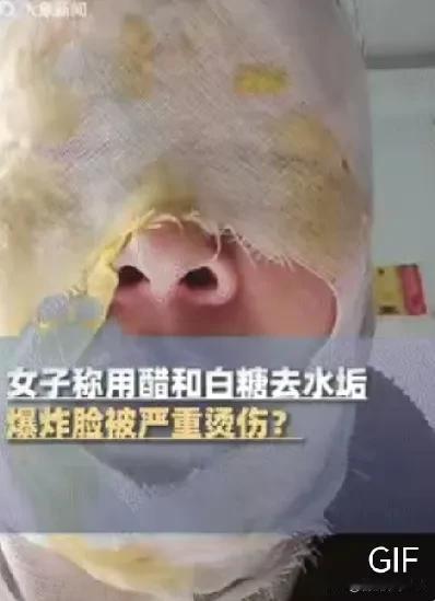 这下悲剧了！河北邯郸，一女子在家烧开水时，见保温壶里有很多水垢，就模仿“网络小妙