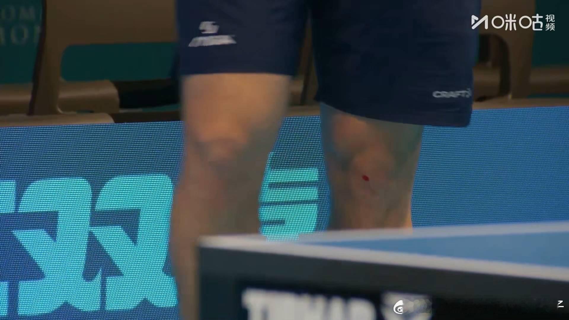 2026年国际乒联欧洲16强杯卡尔松为了救球擦破了膝盖，因为出血了，所以进行医疗