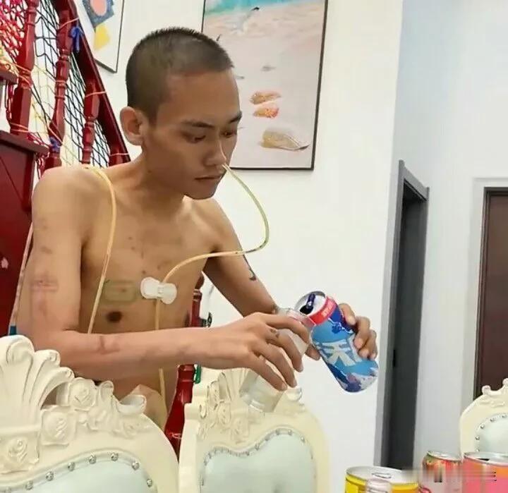 男子肠癌晚期已无力回天，身上虽然插着管子，但是估计他也想开了，开始独自喝起小酒。