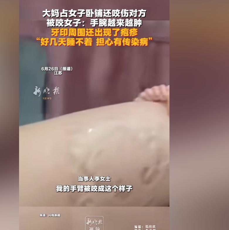 花钱买下铺却被大妈强占，争执中惨遭咬伤，姑娘伤口起疱疹夜夜难眠：就怕染上传染病。