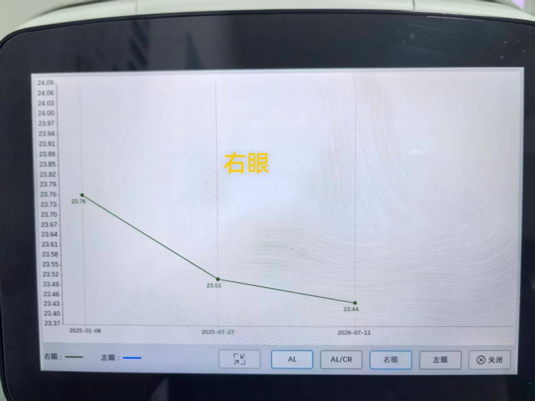 前两年小朋友散瞳检测出来近视 100 度左右，后来买了某品牌的防控眼镜，就是防止