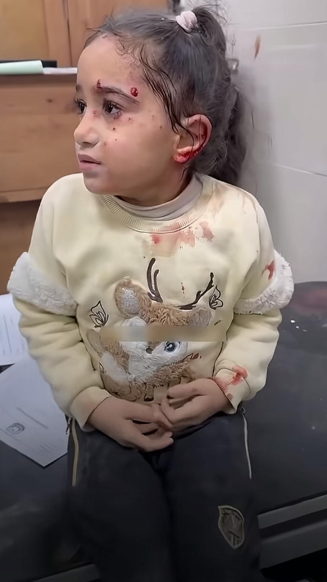 他们还能不能长大？浑身发抖，身上血迹斑斑，眼神无助可怜。
战争，疾病，贫穷是世界