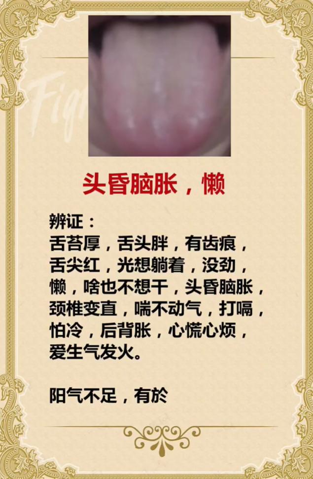 总头昏脑胀、浑身发懒？多半是阳气不足、体内有瘀