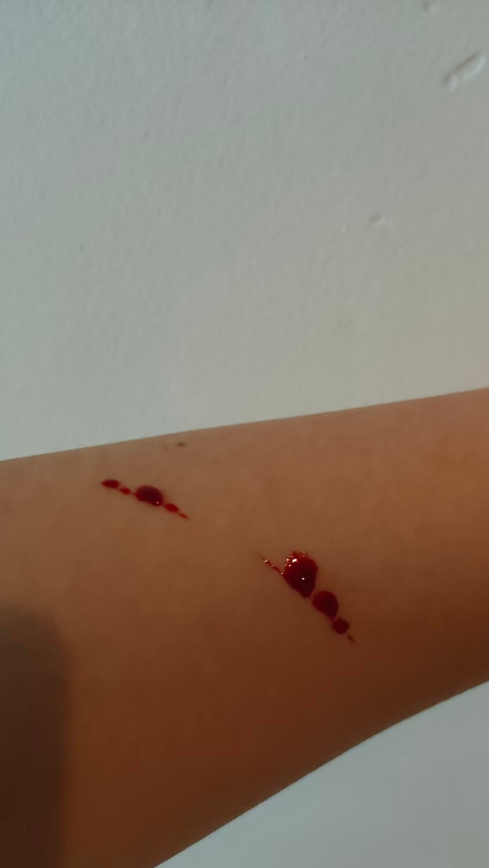 我被玻璃不小心刺伤了 
