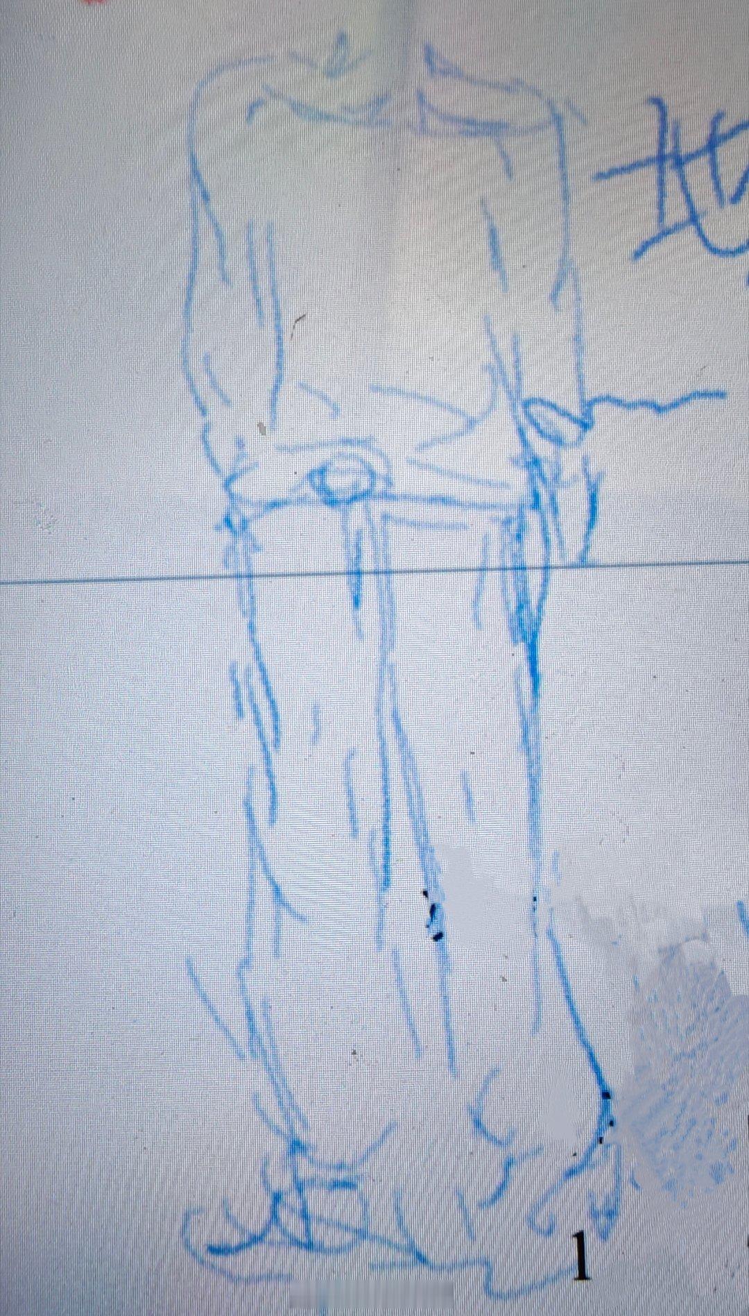 学习呢，瞎画一个无头人 