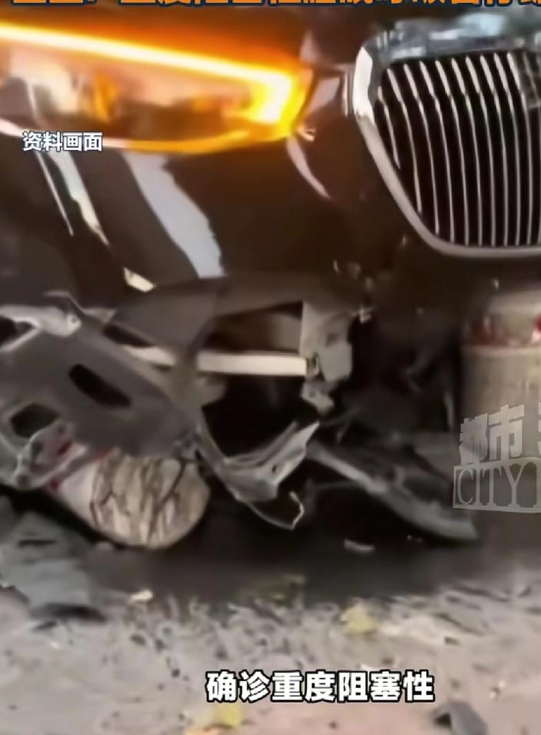 宁波，40多岁的张先生，竟一年撞坏3辆豪车，本以为自己“中邪”了，结果医生一查不