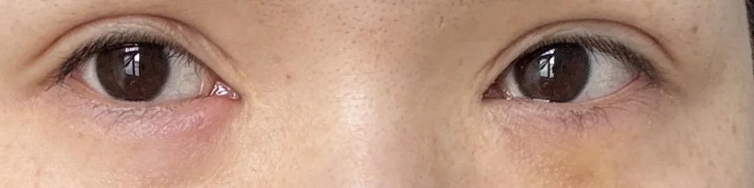 有多缺觉只有我们自己知道