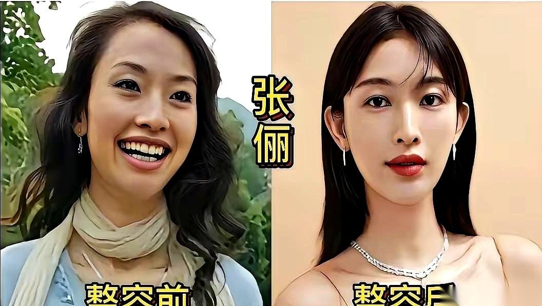 网上聊起明星动脸这件事，总有人觉得是见不得光的秘密，但把早年的荧幕录像和现在的特