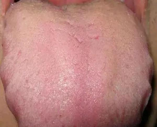 湿气重的健康科普：如何正确选择中成药调理

在中医理论中，湿气重是一种常见的体质