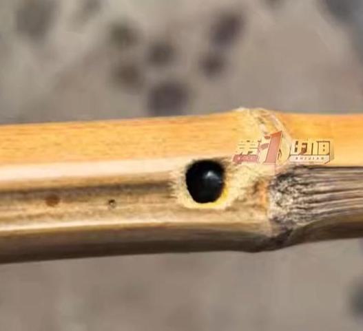 雅安詹女士拿旧竹扫把扫地，手刚握住就被里面竹蜂蛰伤，二十分钟手掌直接肿成发亮馒头
