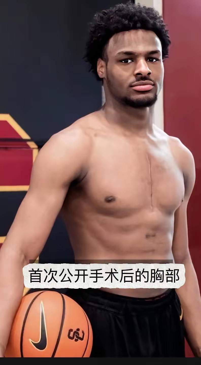 奥尼尔与詹姆斯作为顶尖篮球运动员，心脏也强于旁人，为什么他们的孩子心脏那么脆弱。