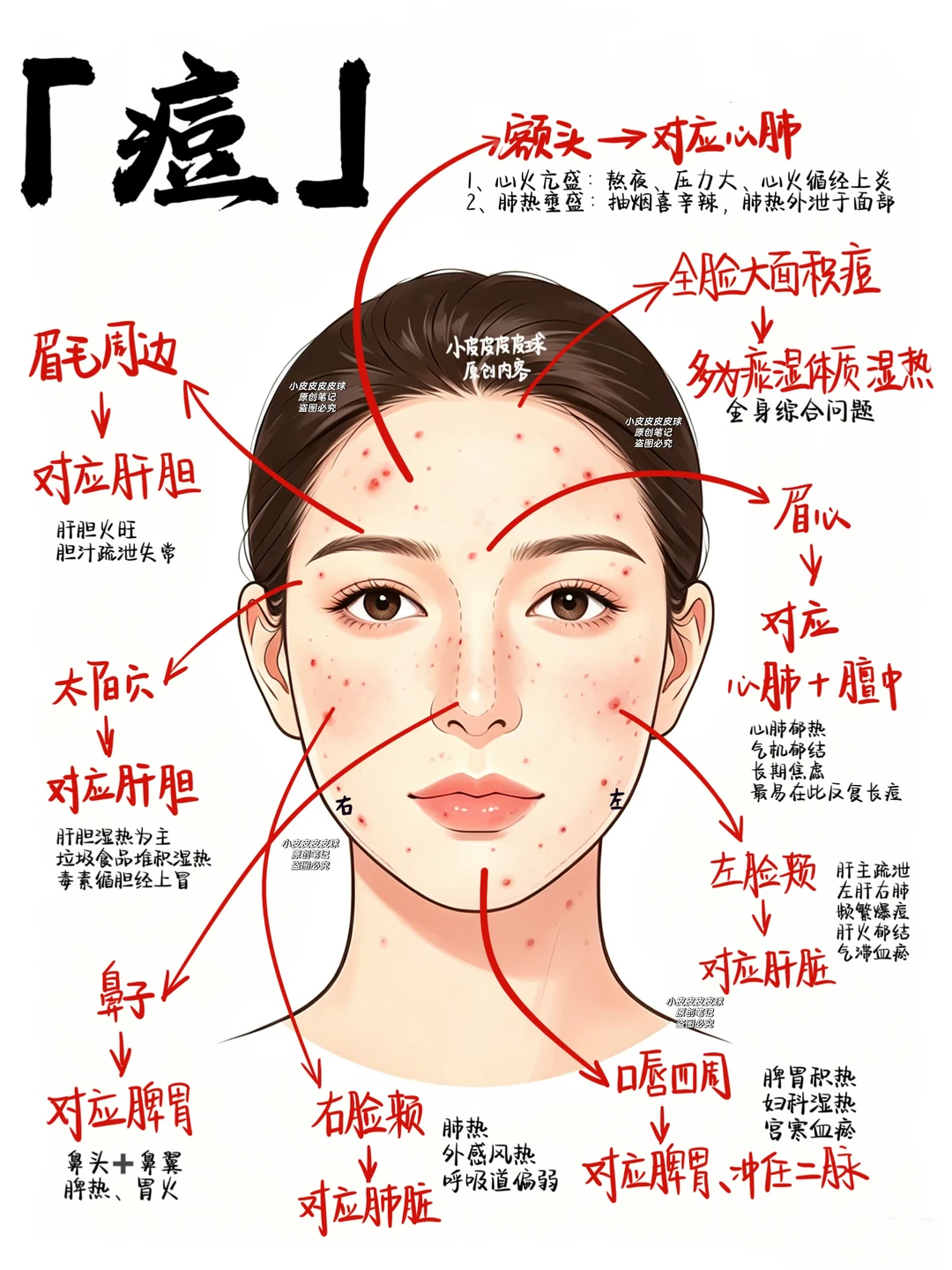 中医说：脸上的痘痘是哪里出了问题？