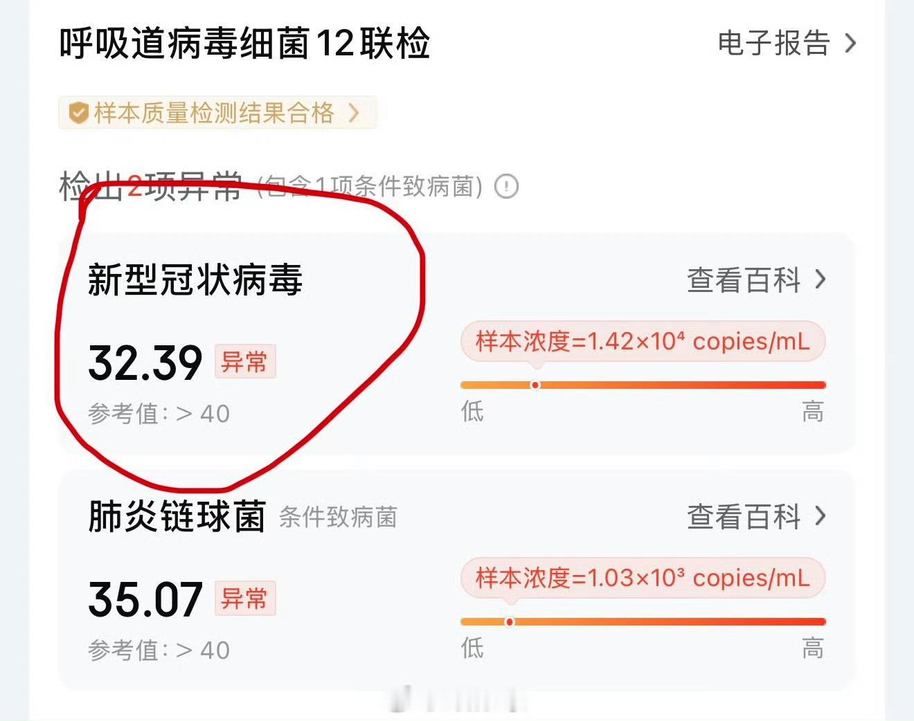 新冠又来了我上月初刚感染过当时症状就是嗓子感觉有点干，轻微疼。 