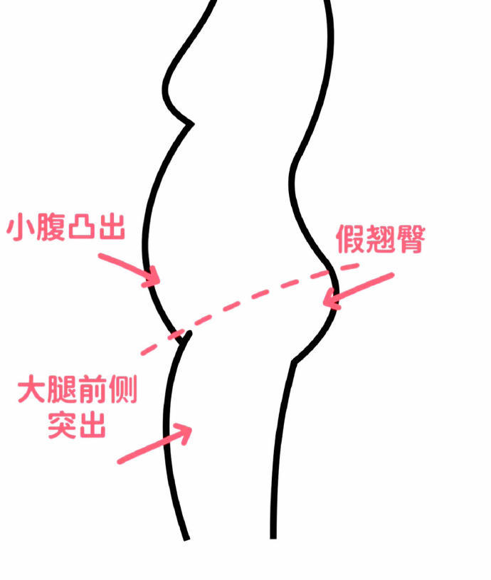 这种体态很好改善‼️每天必练几个黄金动作 ​​​