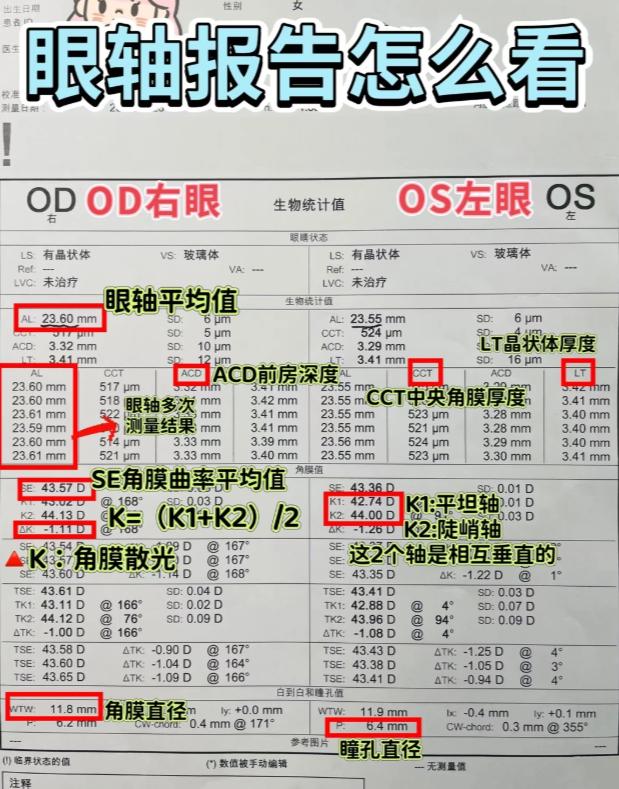 一图教你学会看眼轴报告单
1. 眼轴长度（AL）
评估是否属于轴性近视。角膜曲率