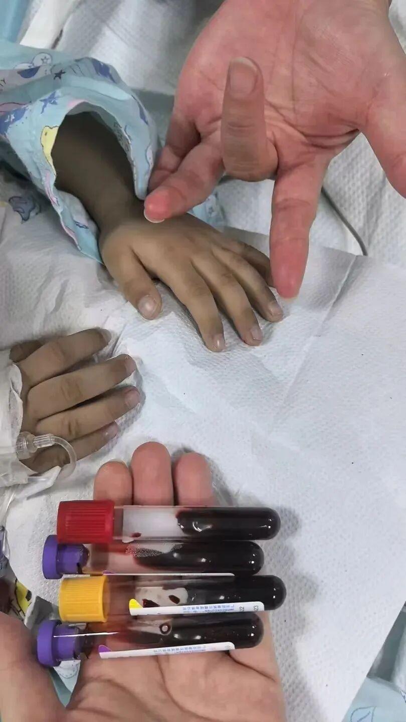 广东顺德，一名3岁男孩的幼儿园老师，发现孩子嘴唇和四肢都出现不正常的青紫色，就劝