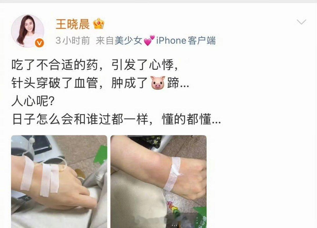 王晓晨自己发微博说吃了不合适的药，引发了心悸，人心呢？日子怎么会跟谁过都一样，懂