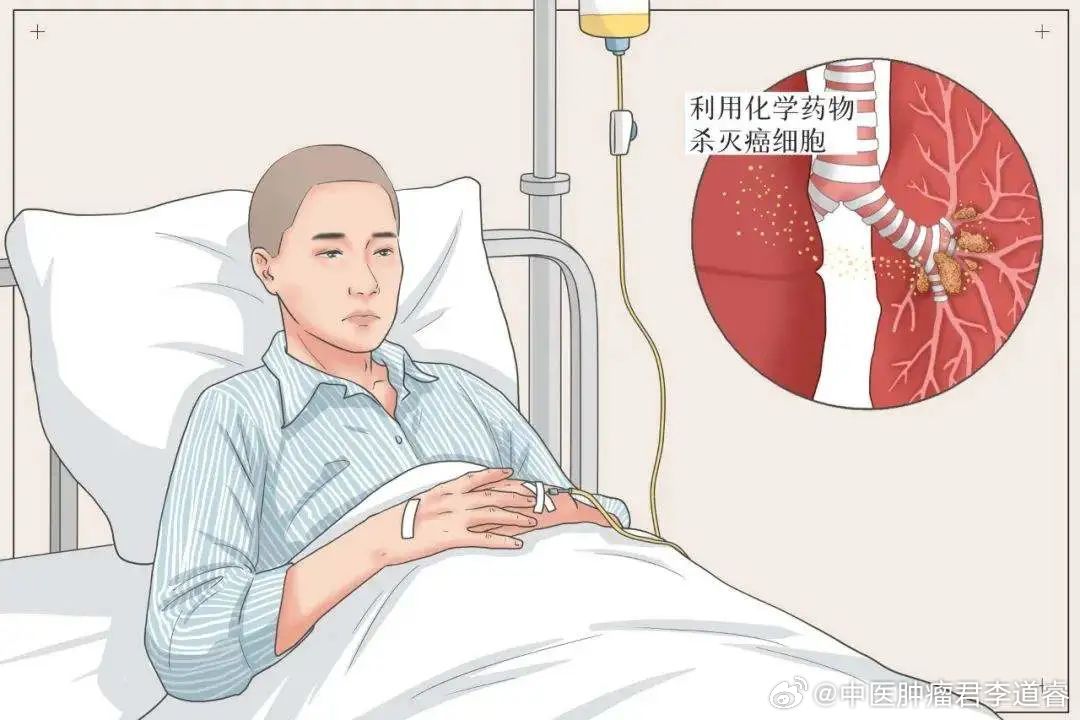 【化疗后手脚麻木刺痛？6大非药物干预法帮你缓解】肿瘤防治科普  许多化疗患者会遇