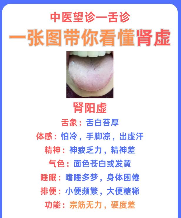 望舌辨肾虚：一张图分清肾阴、肾阳、肾气不足