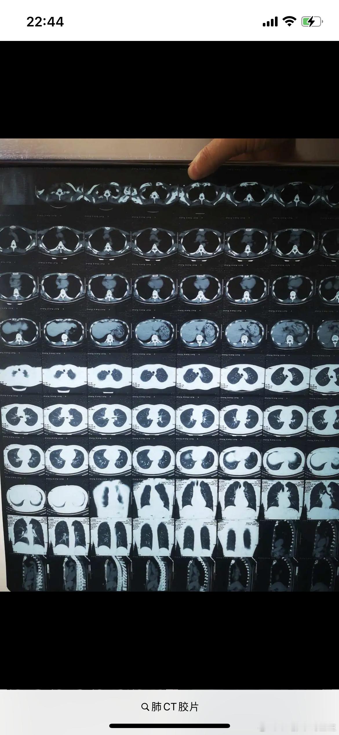 继续来说下CT片数字化的事情。由于可友的业务主要是线上，特别是肺结节咨询和体检解