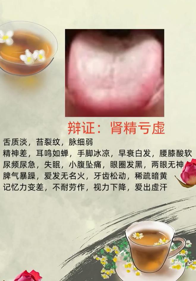 舌淡有裂纹脉细弱，多是肾精亏虚的典型舌象