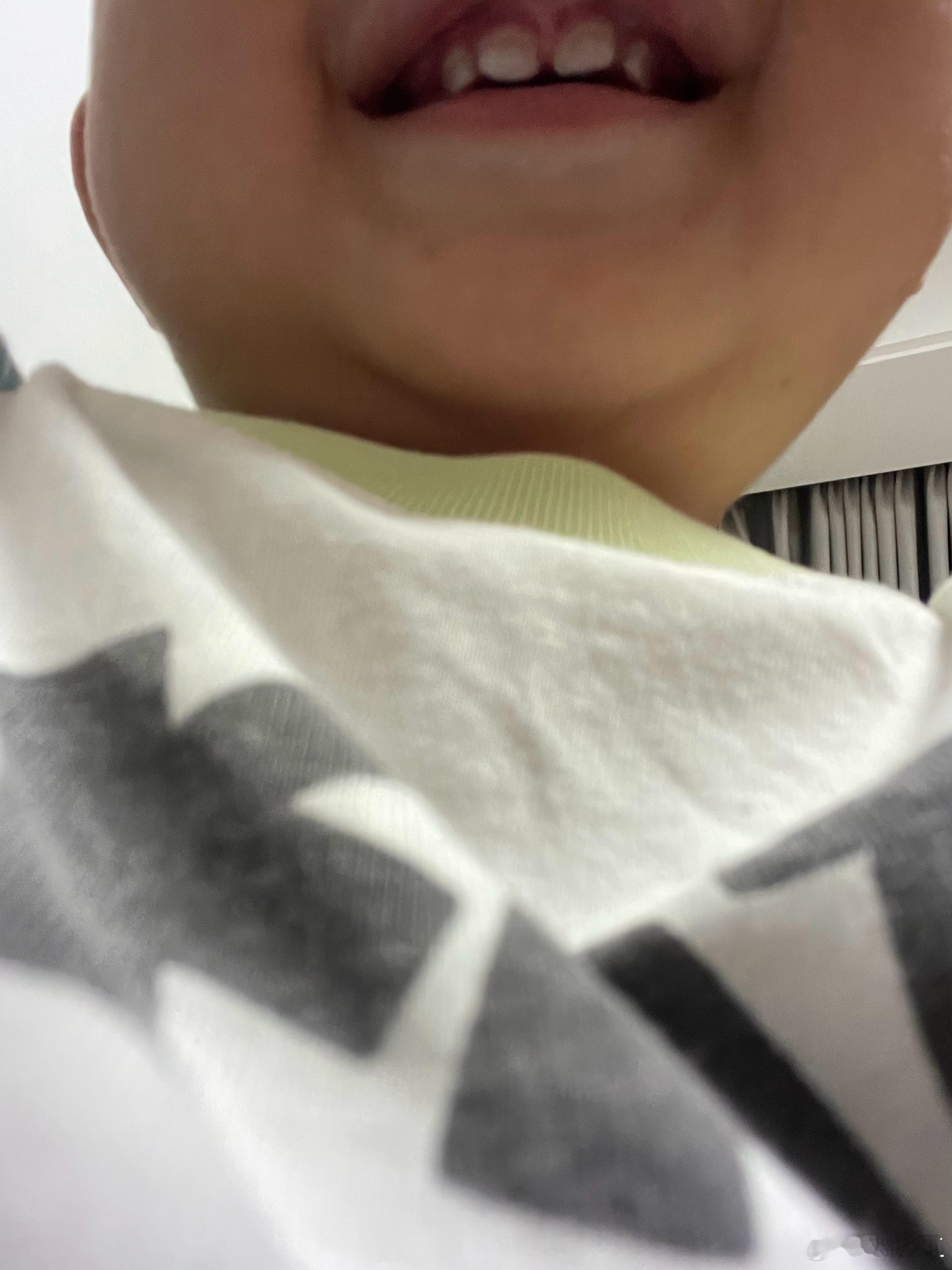 今天还是我儿子的出生日，去年这时候正在医院呢。稀里糊涂的都一年了，是真快。一年时