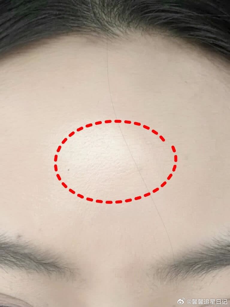 原来溶解出800%的黄气是这种感觉 三个月前的哈哈我：色沉、肤色不匀、像个油腻腻