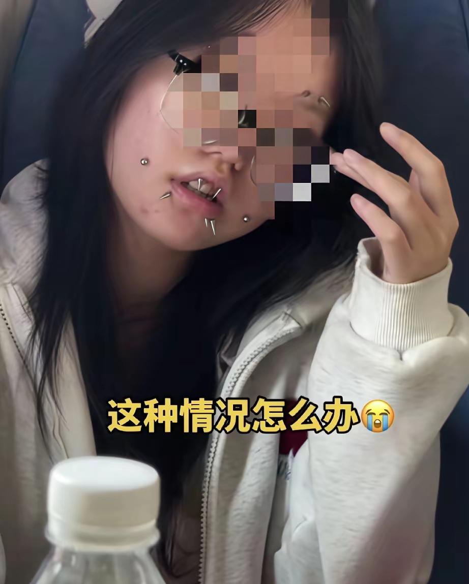 像她这样情况，还有得救吗？
打这么多钉子，不仅不能给你的长相加分，还会给你的智商