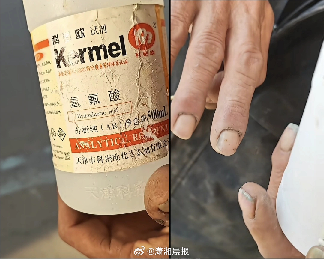 【河北一#农村老人捡到氢氟酸不慎滴到手指#，#卫生院医生回应氢氟酸滴到老人手指#