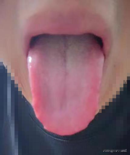 肾虚不可怕，可怕的是脾肾两虚加上肝气郁结，补不进去，疏不出来

这个患者怎么是怎