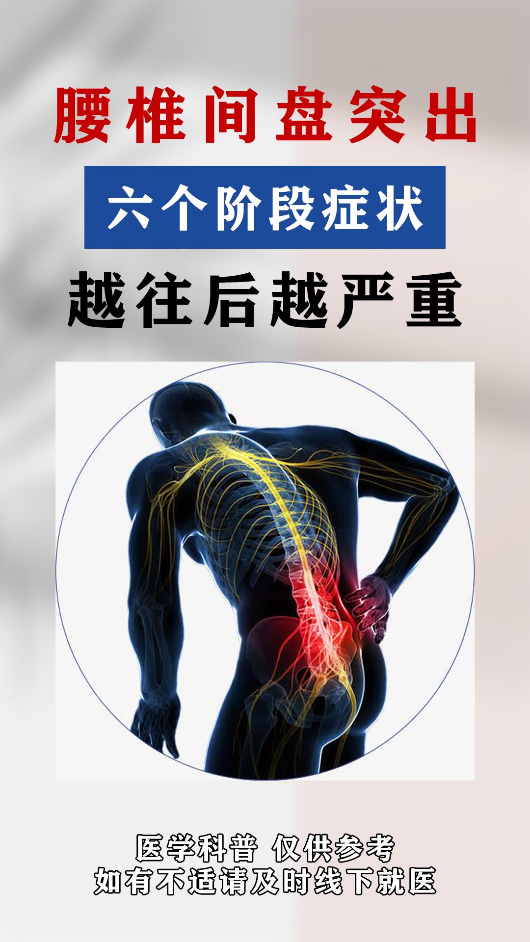 腰椎间盘突出