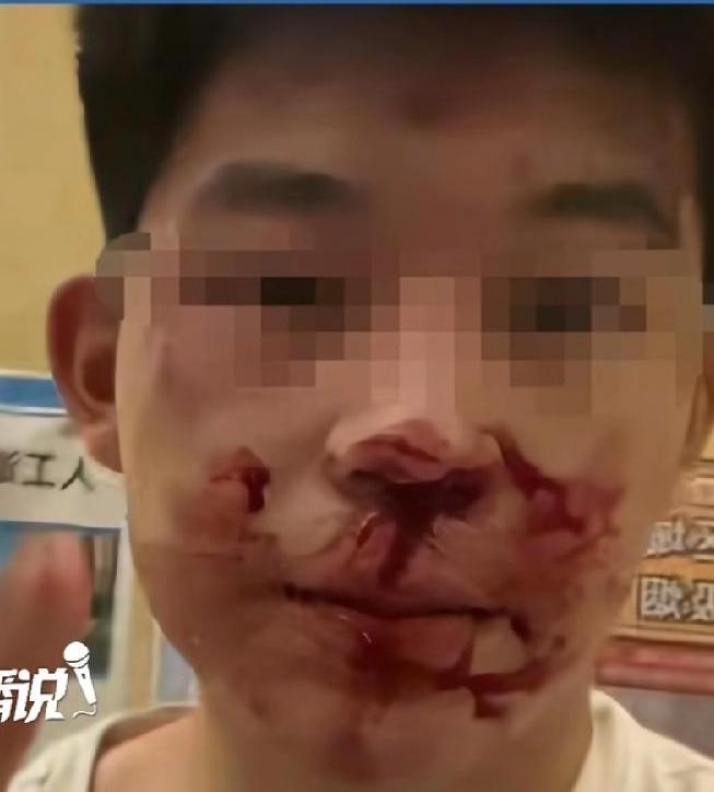 运城冒充警察打人王某某已被刑拘！高考也白考了！寻衅滋事罪，政审都过不了，高考建档
