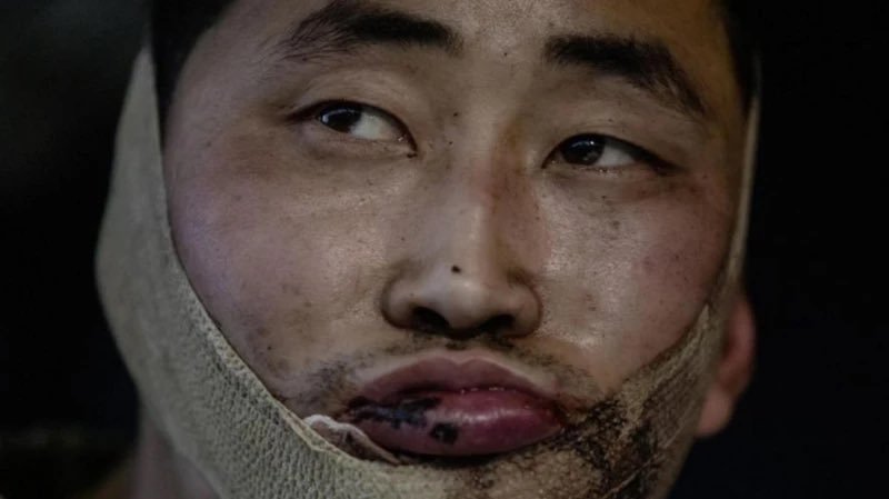 韩国联合参谋本部认为，在俄罗斯西部库尔斯克地区遭受重大损失（死亡人数超过 1,0
