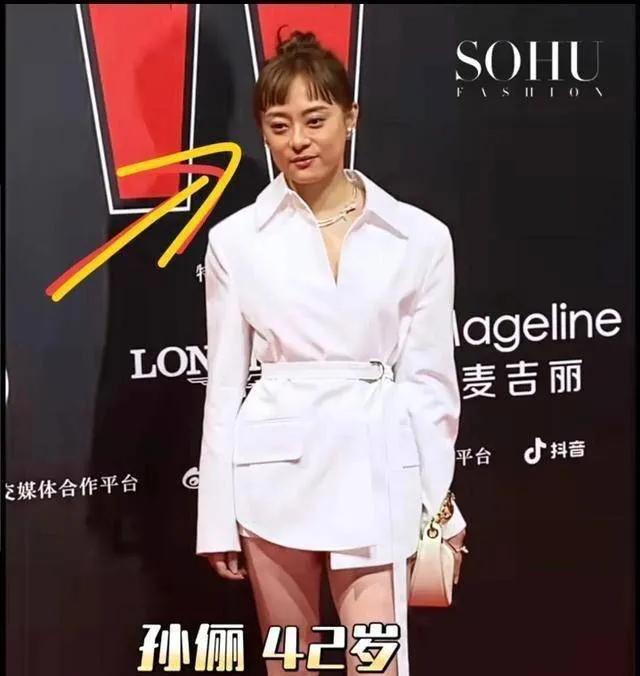 孙俪总是在关键时刻掉链子：这一次的红毯造型更是备受诟病，脸部浮肿身材走样，状态直