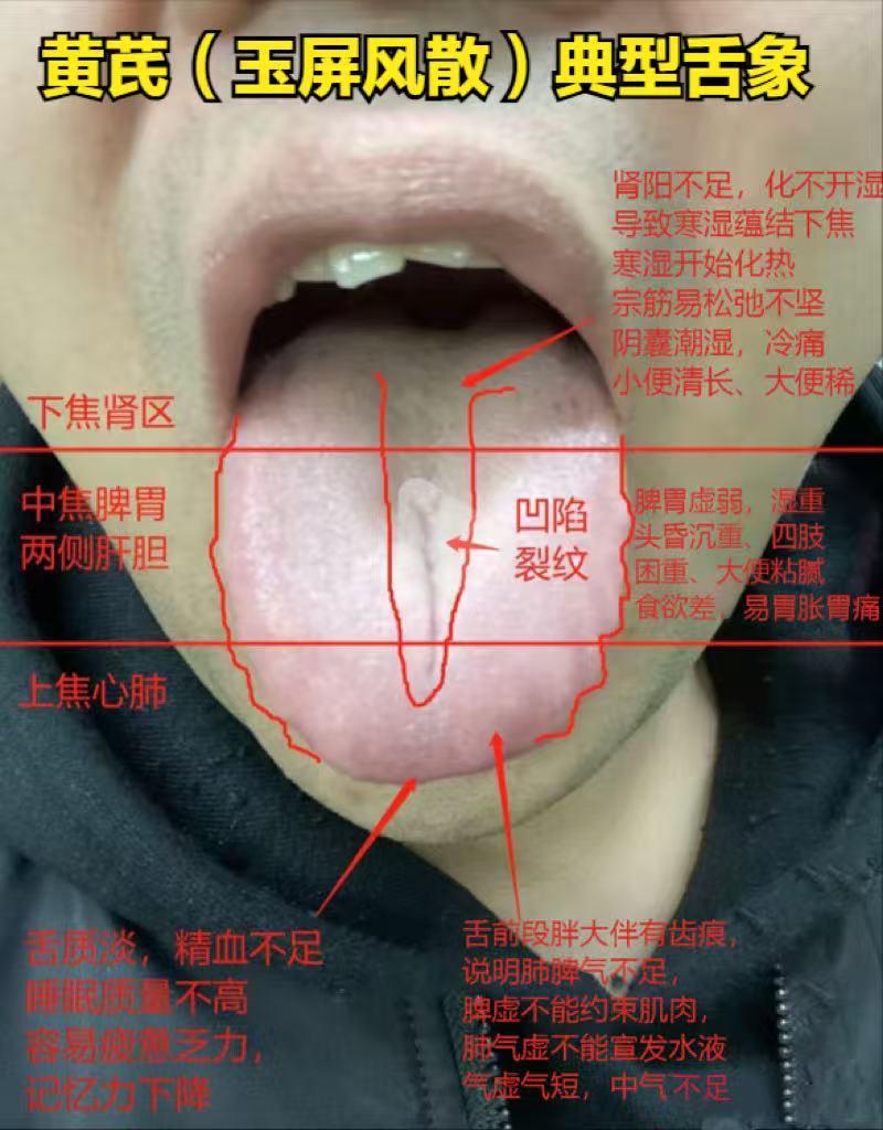 黄芪补卫气，人参补元气！中医揭秘：补错气反伤身，90%的人都吃错了！

①黄芪—