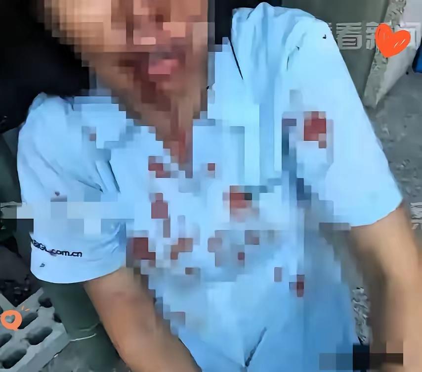 太解气！上海舅妈面对上门围殴，反手一泼守住正义，二审终于不搞“谁伤谁有理”！
 