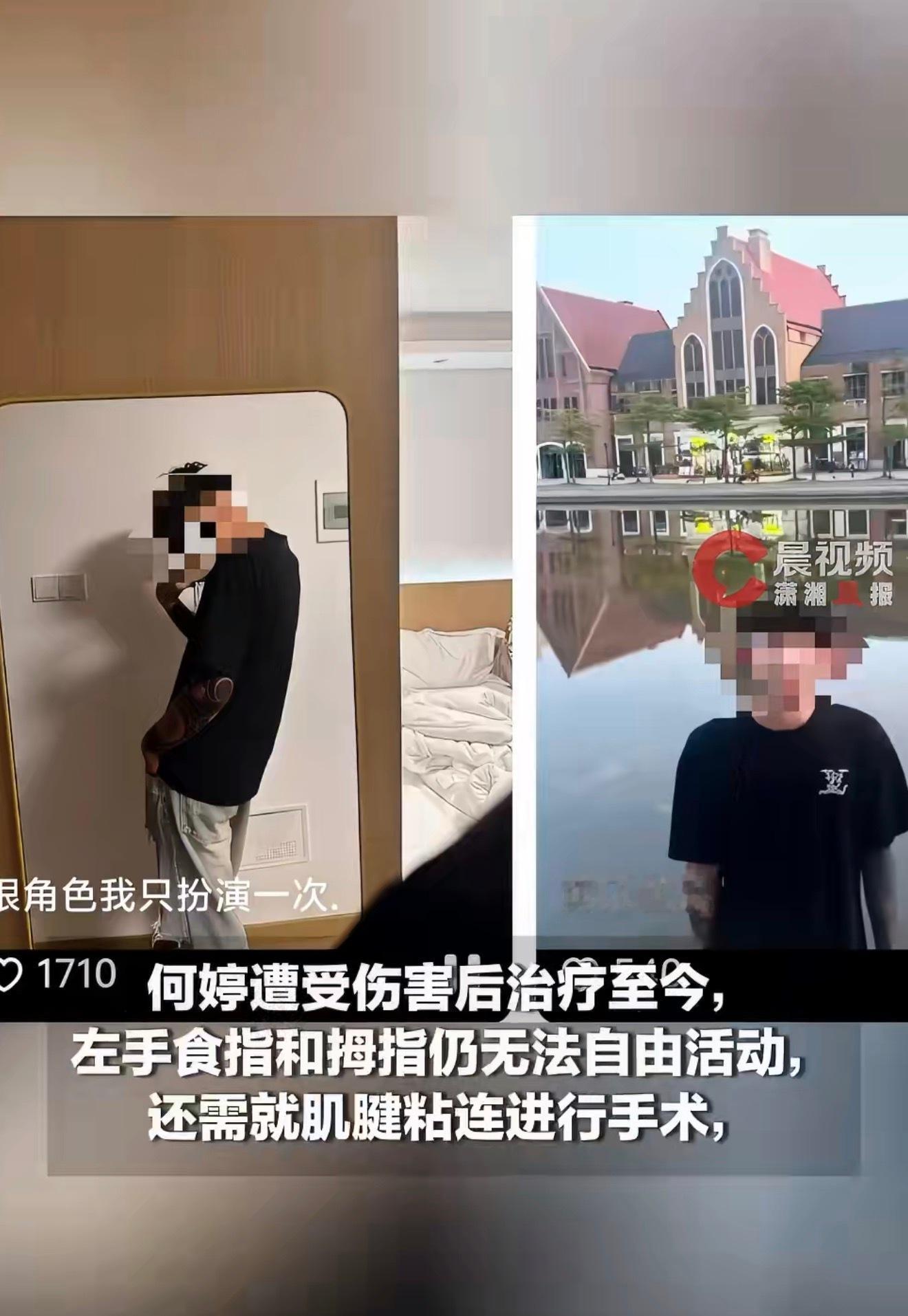 双胞胎一死一重伤案姐姐治疗至今2024年发生的事，死刑都便宜这种人了，有的人天生