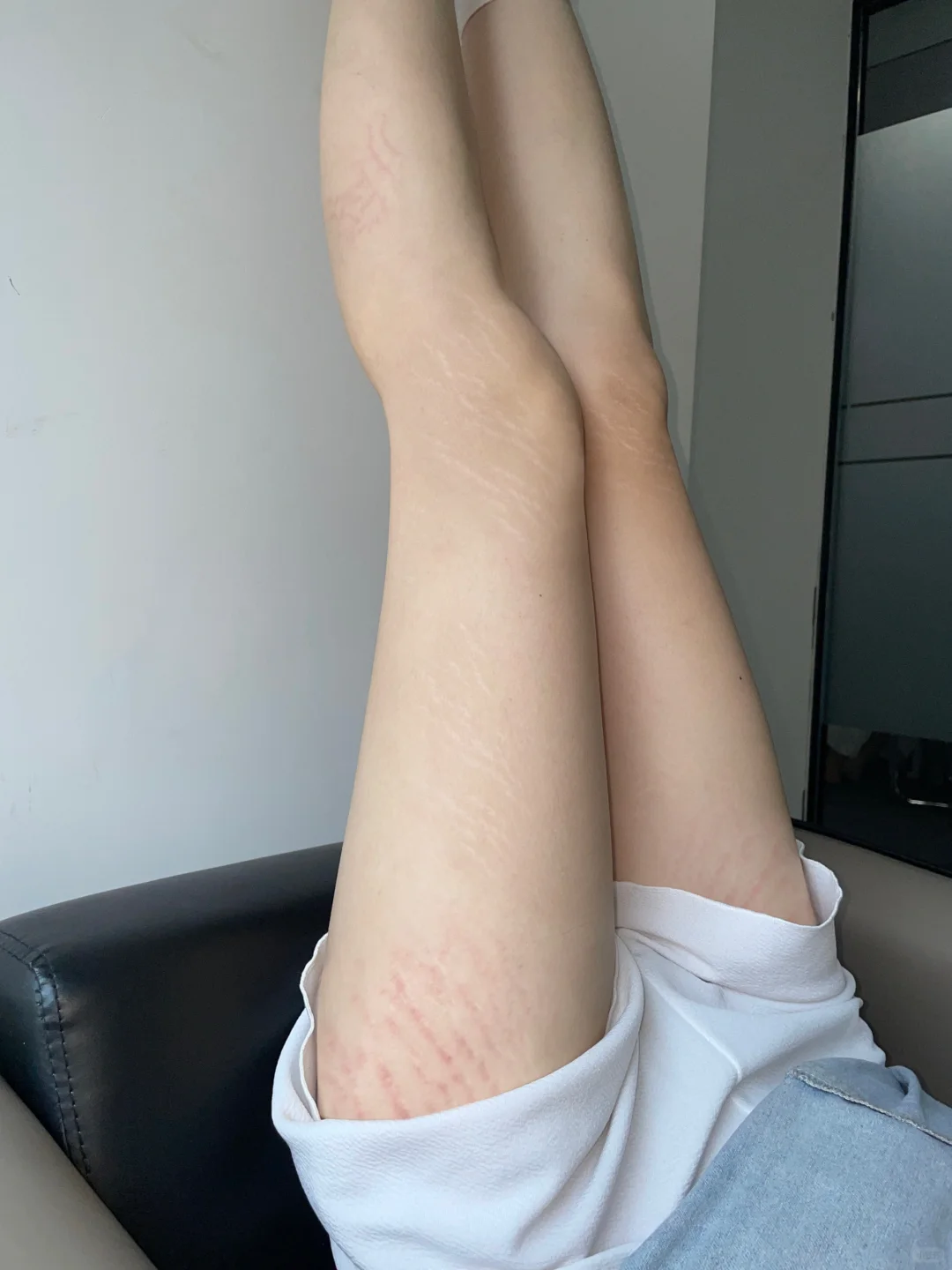 真心劝那些有肥胖纹的姐妹。。。