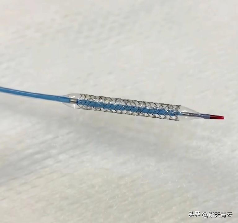 很多人对心脏支架充满误解，要么谈之色变，要么过度依赖，却忽略了它的本质：是疏通心