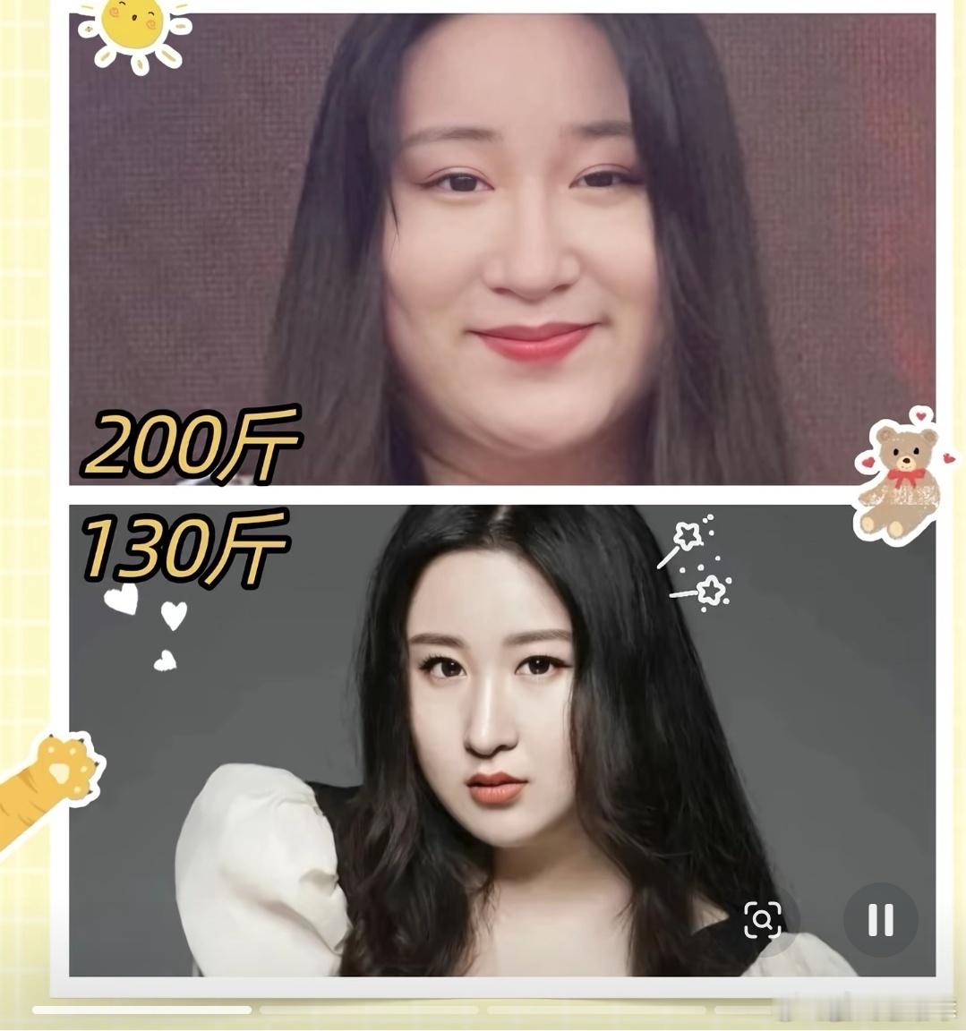 锤娜丽莎回应打针减肥质疑减掉了好多啊，肯定很不容易，结果还被别人说是打针打的，真