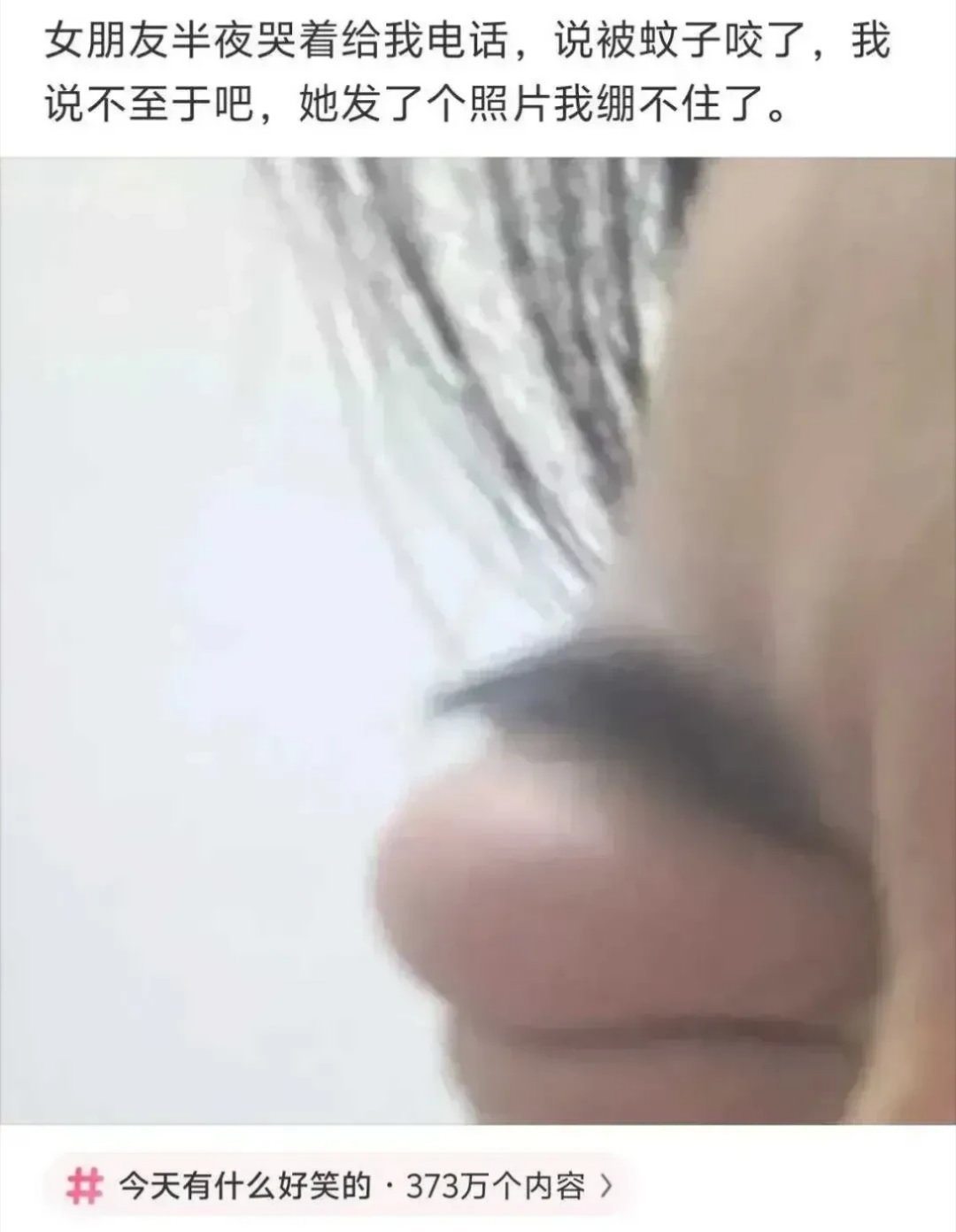 这蚊子咋这样！ 