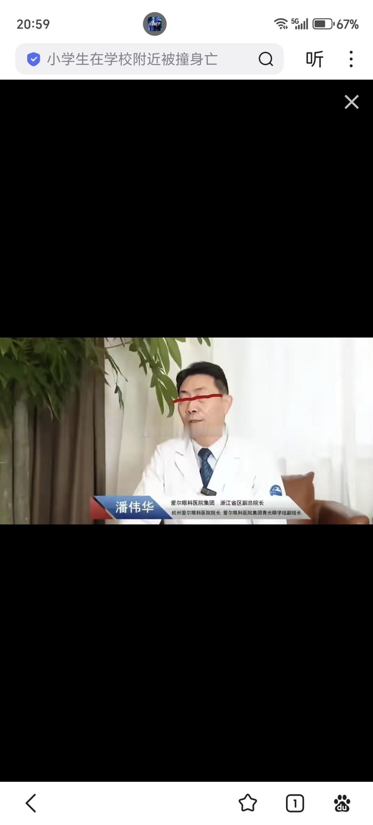 杭州爱尔眼科那个50多岁的潘院长，这次真是把“斯文败类”四个字给演透了。
28岁