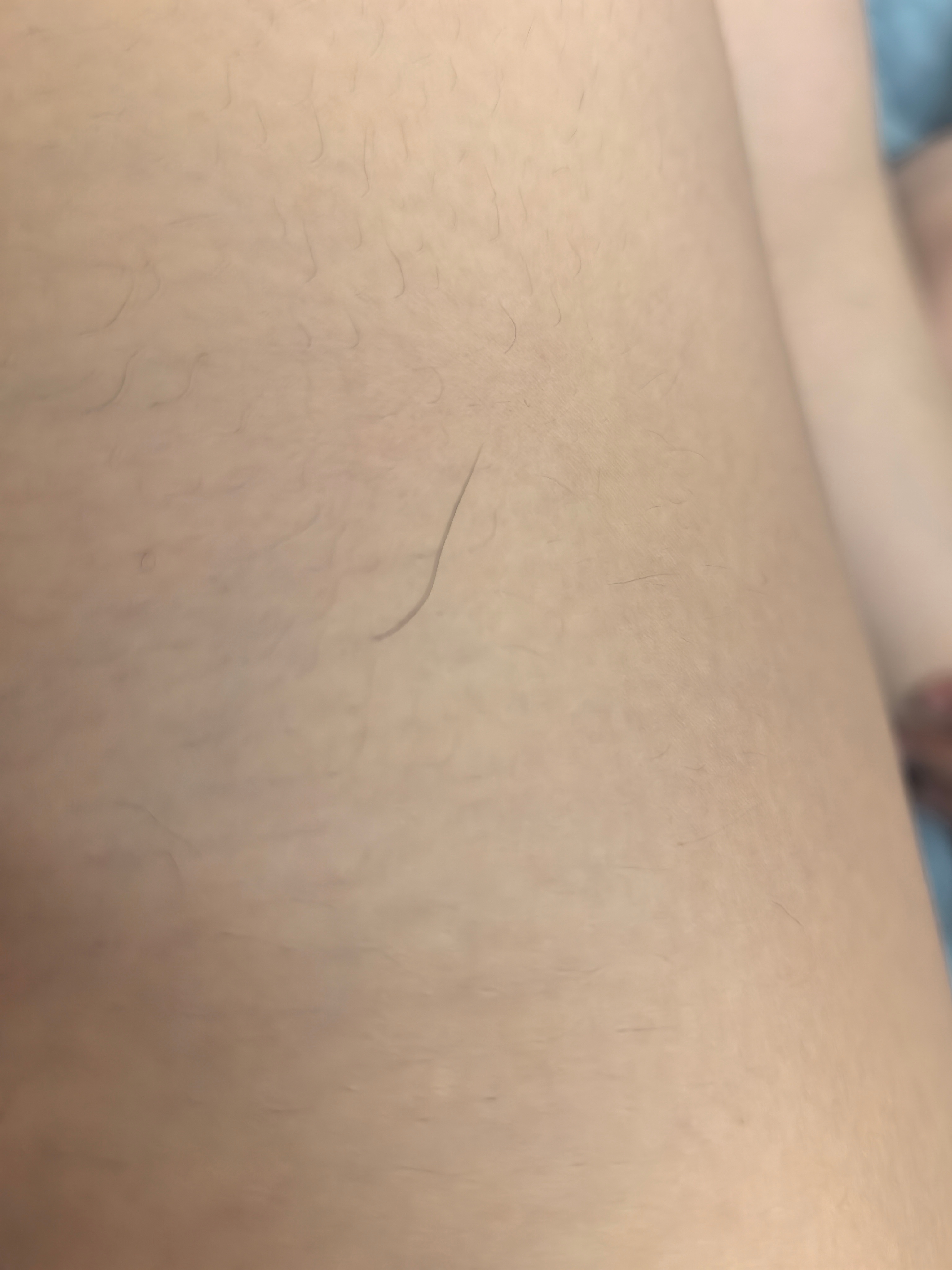 我大腿莫名其妙长了一根腿毛又粗又长，我女儿想拔掉，我说不能拔，很痛，她天真地问我