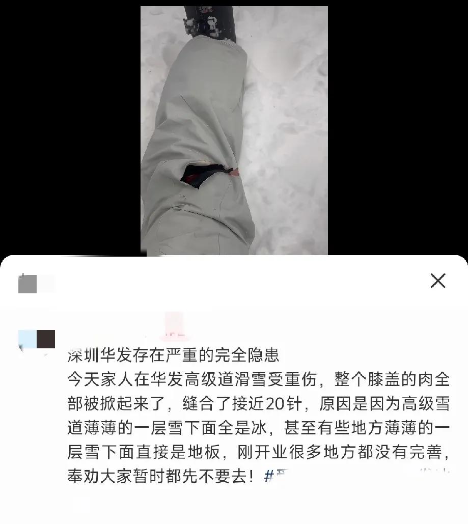 深圳前海冰雪世界开业第一天就出问题了！
有人受伤！引来游客吐槽
冰太多雪太少，有